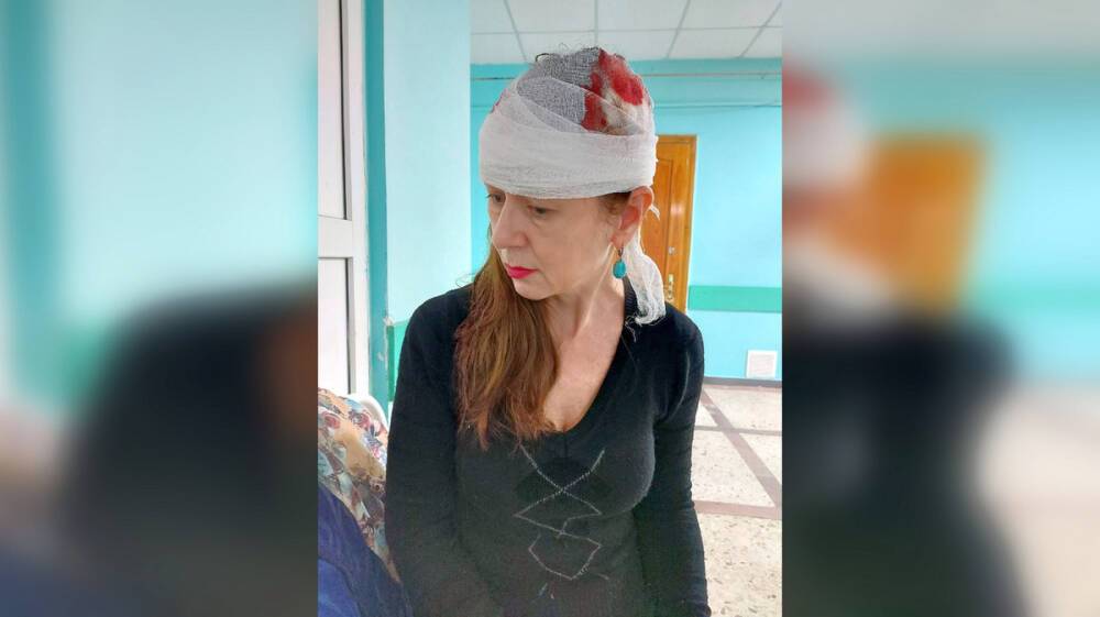 Жительнице Воронежа пробило голову глыбой льда