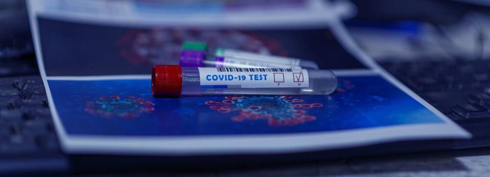 Новый тест на иммунитет к COVID-19 покажет, надо ли делать прививку или нет