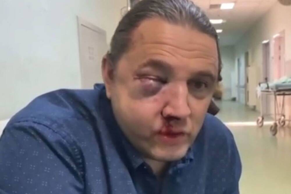 Избитый экс-депутат Шингаркин рассказал о нападении: Выслеживали неделю