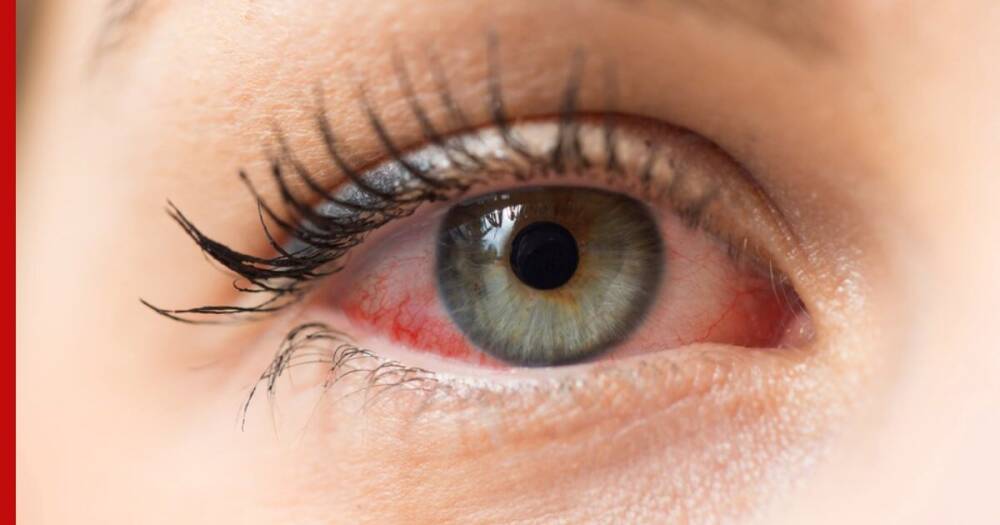 Качество зрения: 5 основных причин покраснения глаз