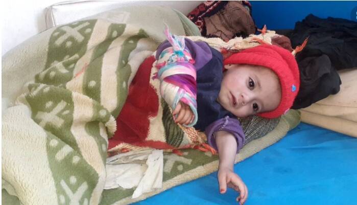 В Афганистане от недоедания или голода умерло более 13 700 детей