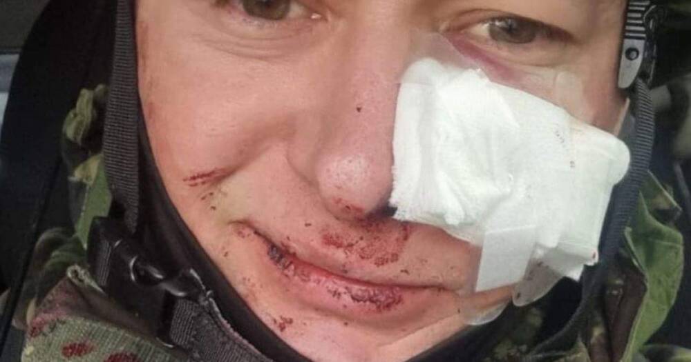 Лидер "Бумбокса" Хлывнюк ранился во время минометного обстрела (ФОТО)