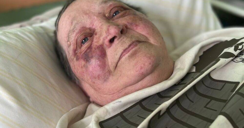В Херсоне рашисты сломали позвоночник 75-летней женщине-волонтеру, которая не хотела отдавать украинский паспорт