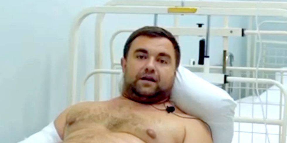 Покушение на Ковалева: нардеп-коллаборант выжил после подрыва в Херсонской области