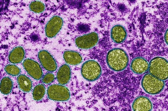 ВОЗ предупреждает о росте заболеваемости коронавирусом и обезьяньей оспой