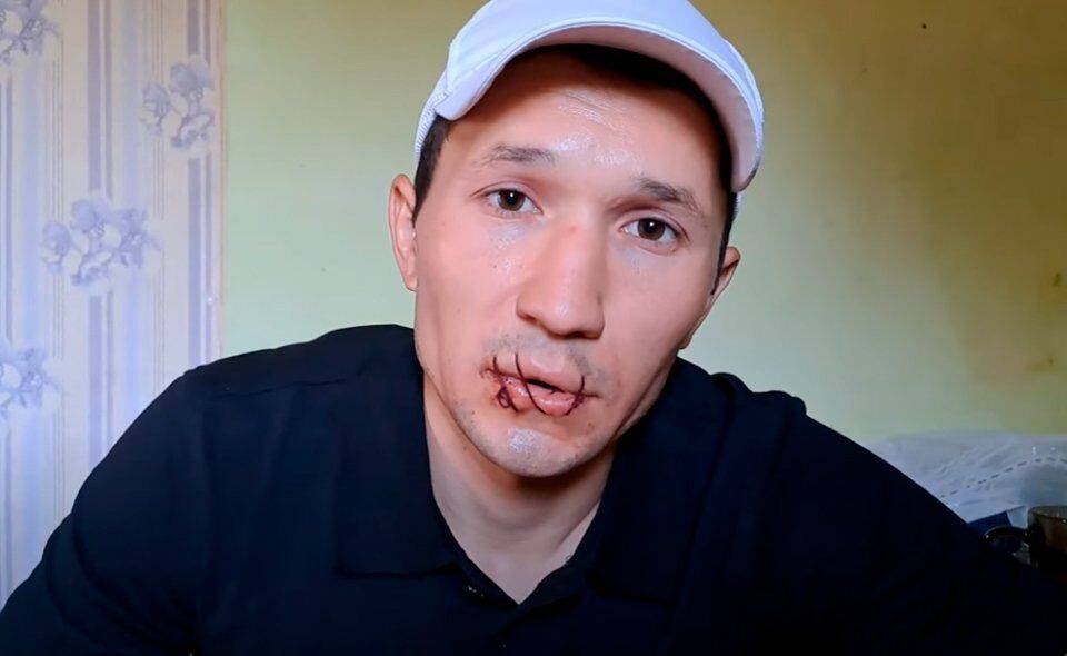 Житель Ташкентской области зашил себе рот и объявил голодовку