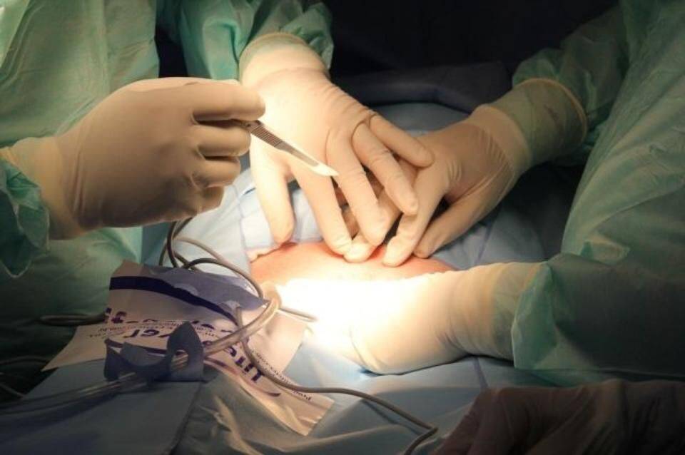 В Самарканде после операции по пересадке печени скончался донор и пациентка