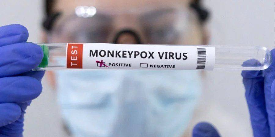 Первый случай оспы обезьян в Украине: в Минздраве заявили, что необходимости в карантине или массовой вакцинации нет
