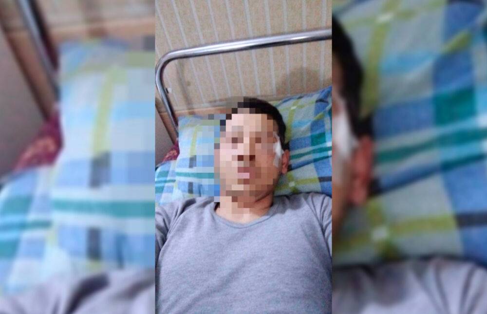 В Ташкентской области избили фельдшера скорой. Сыну пациентки не понравилось, что на вызов приехал мужчина