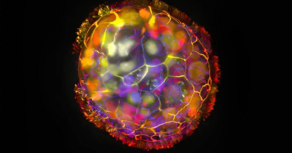 Как взрыв сверхновой в голове: 8 потрясающих снимков из нейробиологии