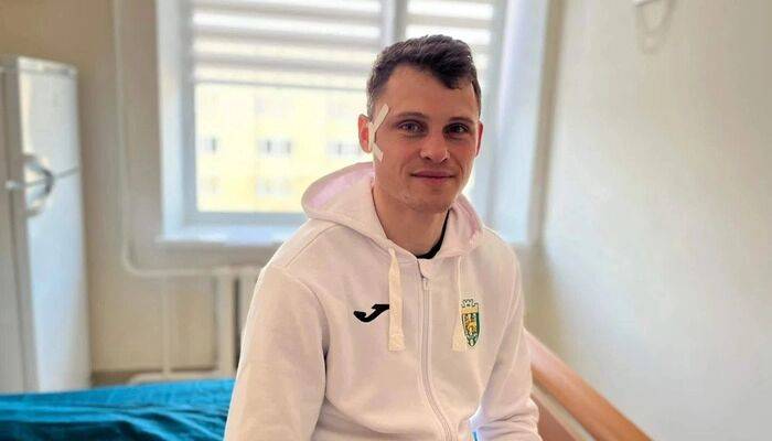 Вратарь Карпат Ильющенков травмировал скуловую дугу