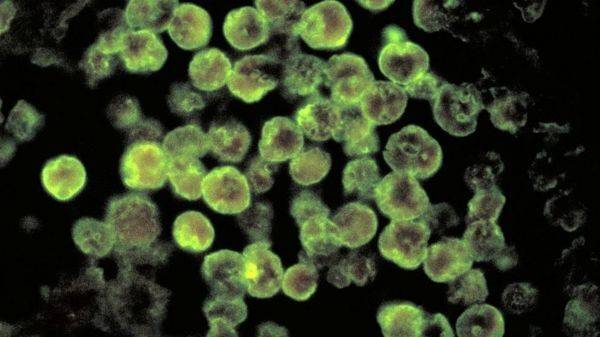 Амеба, поедающая мозг: как уберечься от смертоносной инфекции?