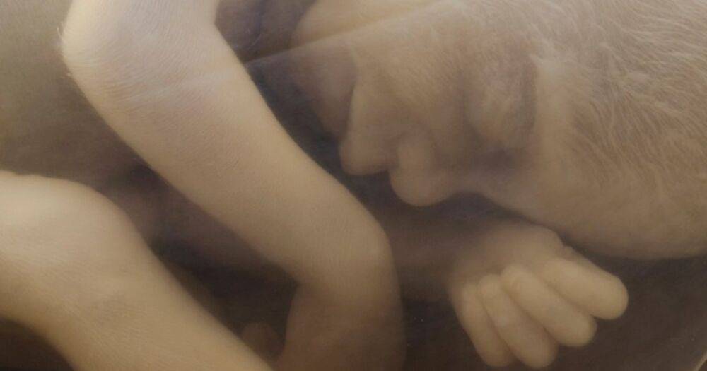 Чудеса микрохирургии. В Китае из мозга годовалой девочки удалили нерожденного близнеца