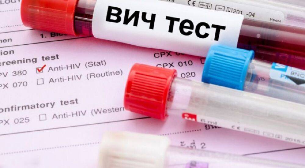 Одесситов приглашают пройти тест на ВИЧ: где это можно сделать | Новости Одессы