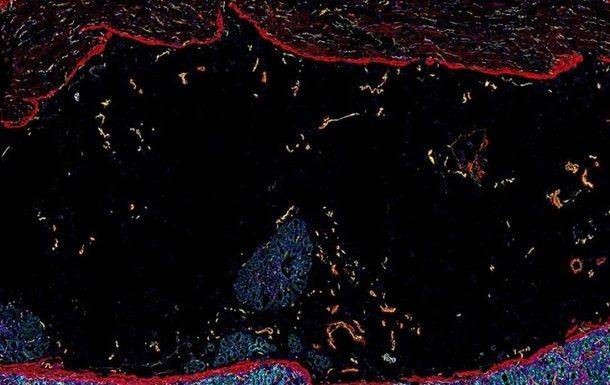 Ученые показали подробную карту человеческого кишечника