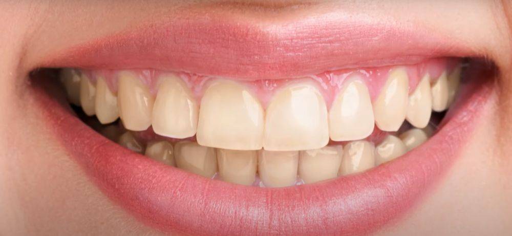 Эти способы могут обанкротить стоматологов: как отбелить зубы в домашних условиях