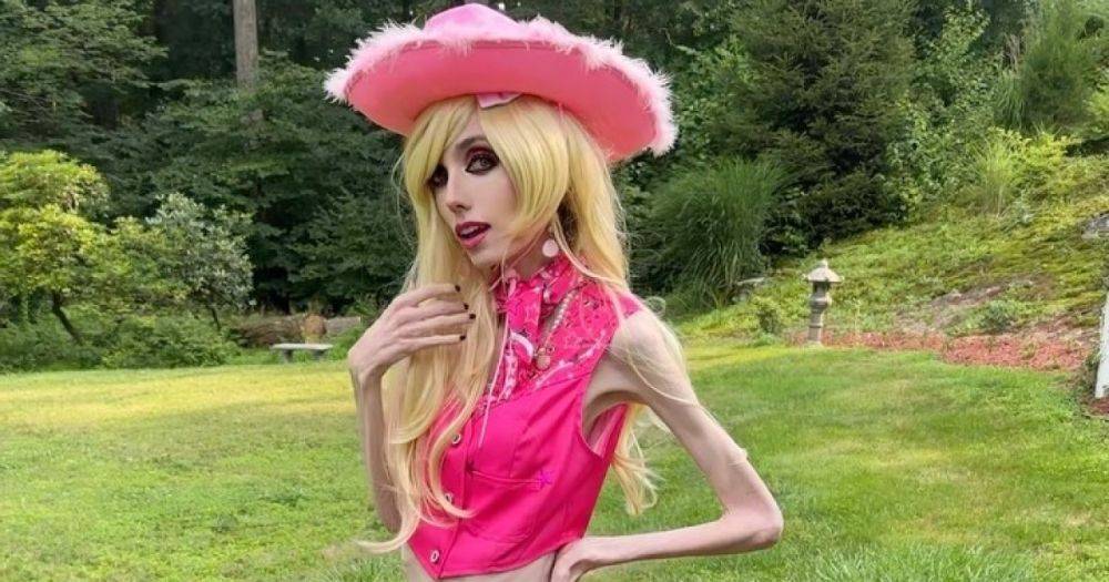 Блогер YouTube с анорексией примерила наряды Барби и вызвала сочувствие подписчиков (видео)