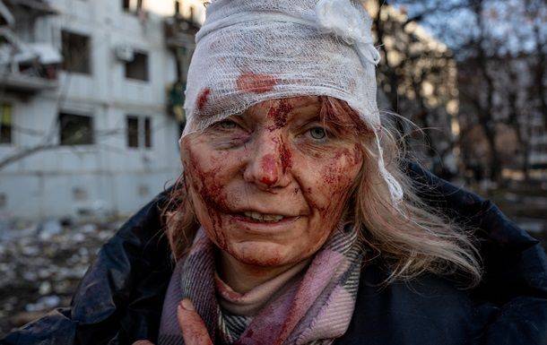 Фото о войне в Украине победили на International Photography Awards-2023