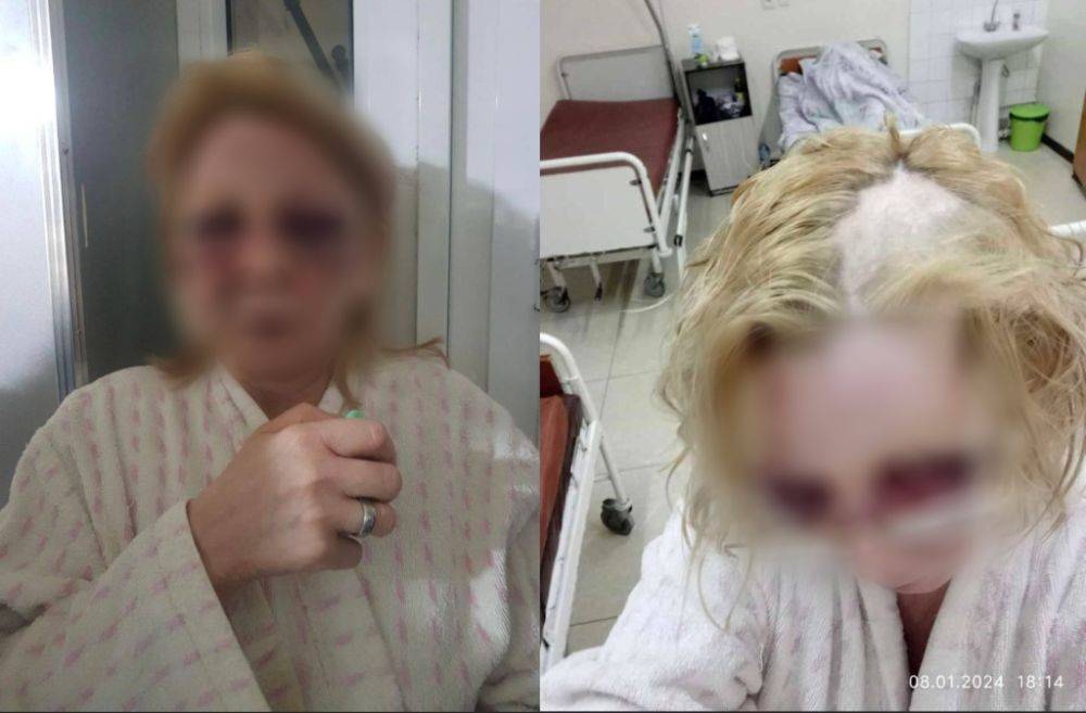В Ташкенте мужчина избил сиделку своей матери. Ему вменяют "легкое телесное повреждение"