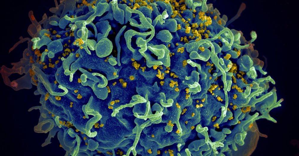 Вырежут ВИЧ прямо из клеток: ученые тестируют редактор генов CRISPR для борьбы с болезнью
