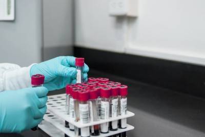 Германия: Тесты на коронавирус скоро можно будет делать дома