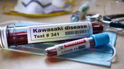 В Казахстане умерли двое детей от заболевания, схожего с синдромом Кавасаки