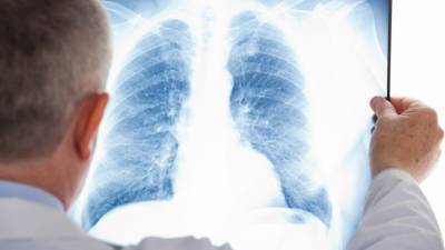 Незначительно снизилось число выявленных случаев пневмонии в РК