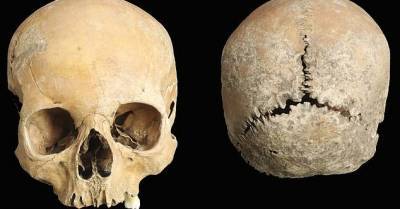 Найденный 60 лет назад череп рассказал о пытках IX века