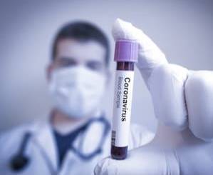 В Ростовской области за последние 24 часа зарегистрировано 269 новых случаев коронавируса