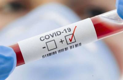 Более половины случаев выявления COVID-19 снова пришлись на Смоленск