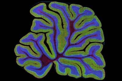 Медики выяснили, что COVID-19 способен проникать в мозг