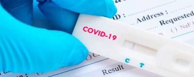 Инфекционист: тесты на антитела к COVID-19 являются пустой тратой денег
