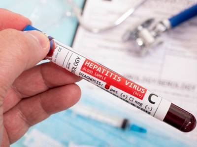 Чарльз Райс - Медики рассказали, как распознать гепатит С и кто чаще всего подвержен этому заболеванию - golos.ua - США - Канада