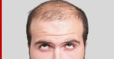 Сладкий осенний овощ может стать причиной потери волос - profile.ru - Франция