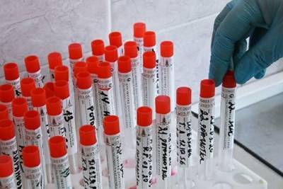 Заболеваемость коронавирусом в Забайкалье в 2 раза выше, чем в среднем по России