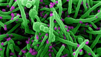 Ученые раскрыли изменения в организме зараженного коронавирусом человека