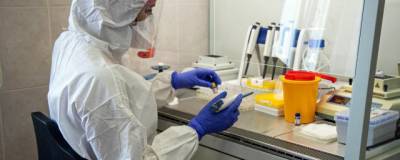 В Петербурге запущено производство тестов на наличие антител к COVID-19