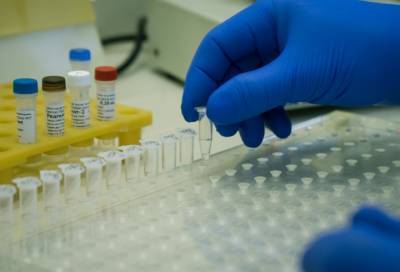 Массовое производство тест-систем на антитела к коронавирусу запустили в Петербурге