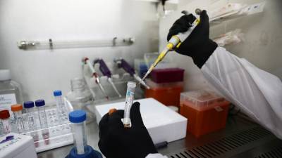 Число случаев заболевания коронавирусом в Израиле превысило 293 тысячи
