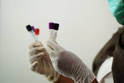В Удмуртии 123 человека заболелеи коронавирусом за сутки
