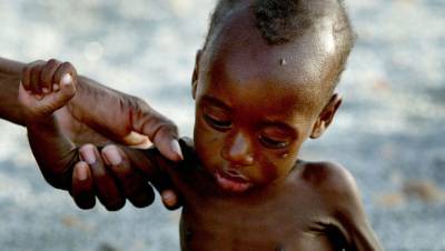 ООН: 7 млн человек умерли от голода в мире с начала года
