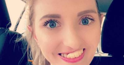 28-летняя девушка лишилась зубов из-за запущенного рака — но продолжает улыбаться