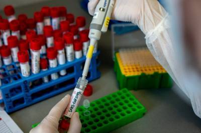 Украина планирует через две недели запустить в промышленное производство отечественные тесты на антиген