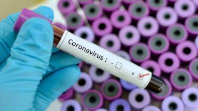 За сутки 83 человека заразились коронавирусом в Казахстане