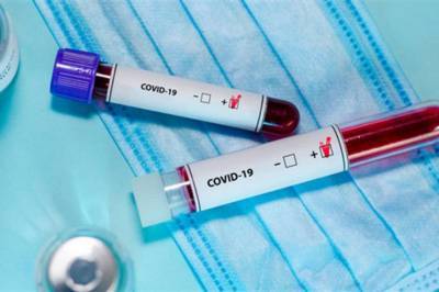В Украине за прошедшие сутки зафиксировали 5590 новых случаев заболевания коронавирусом