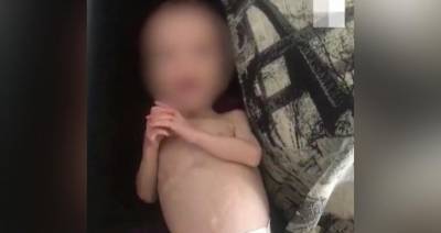 Свердловский детский омбудсмен рассказал о состоянии найденной в шкафу девочки