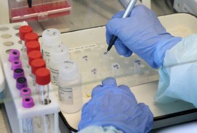 Более 1,6 тыс. новых случаев COVID-19 выявлено в Поволжье впервые с начала пандемии