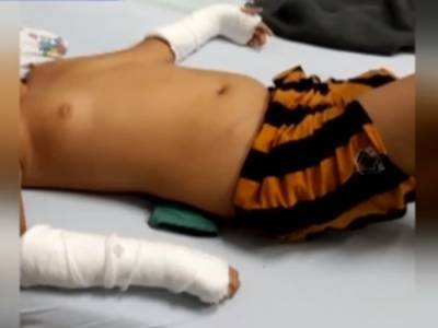 На Закарпатье школьник сломал руки и позвоночник на уроке физкультуры, а учитель не оказал первой помощи – СМИ
