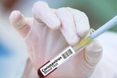 Вакцина «Вектора» от коронавируса поступит в гражданский оборот с 1 января