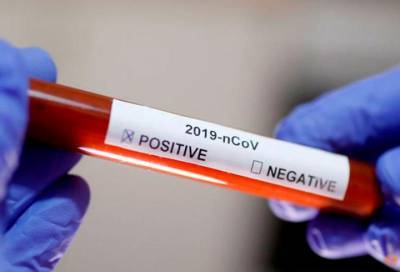 В Ленобласти за сутки коронавирусом заболели 99 человек в 13 районах
